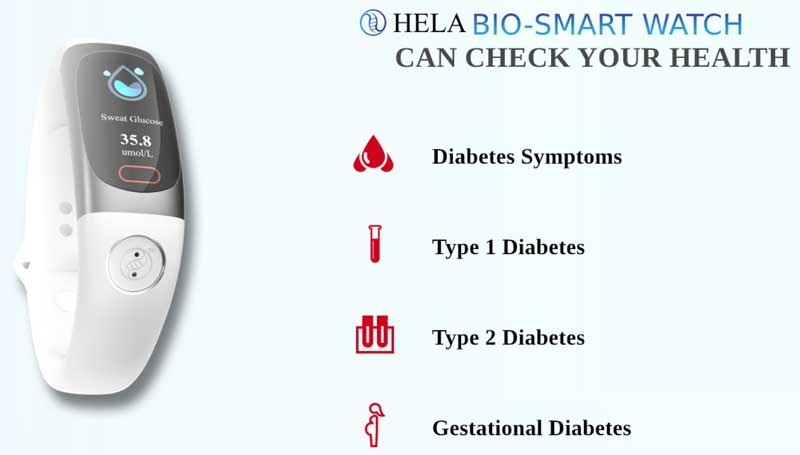 „Hela Bio Smart“ laikrodis